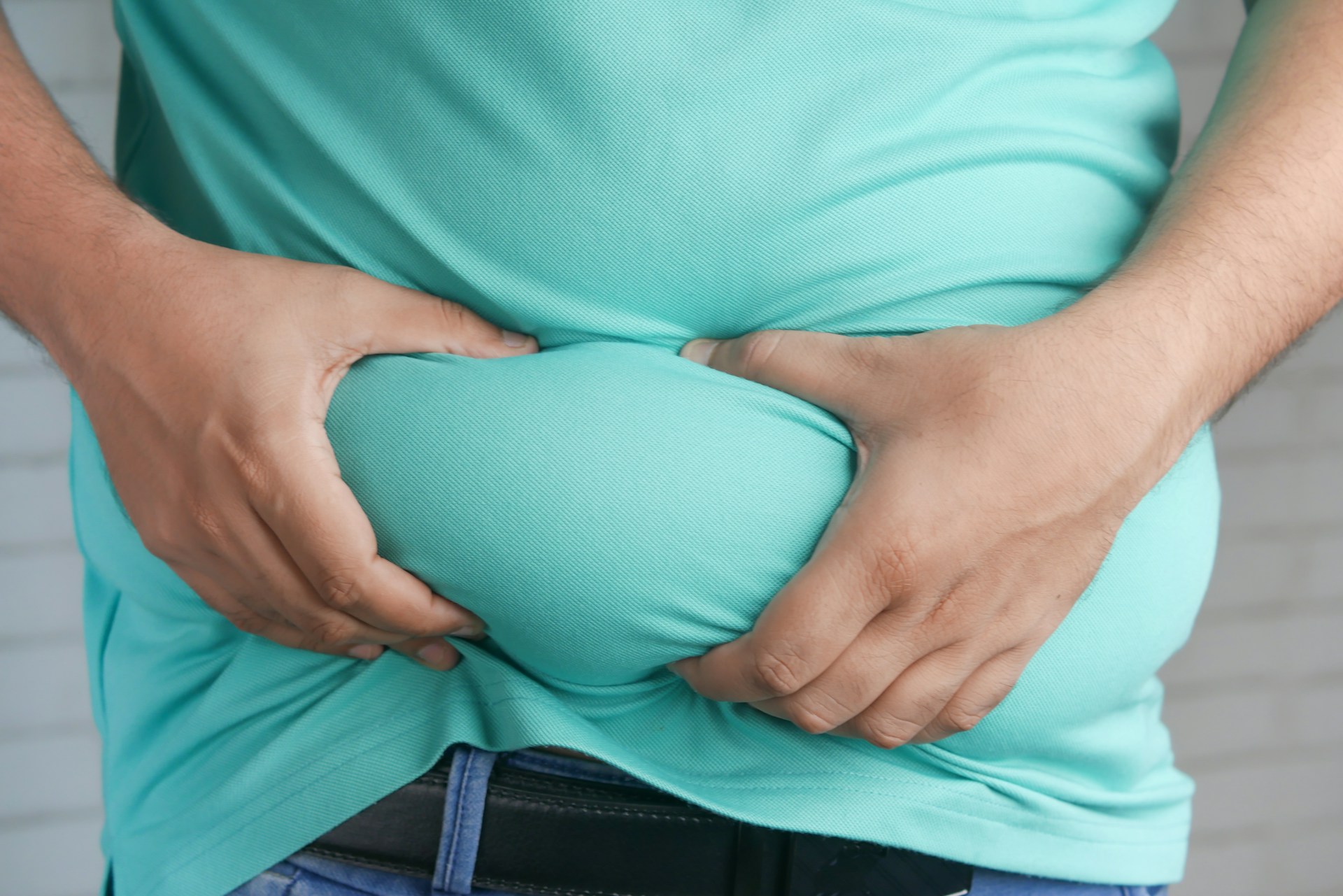 a man with obesity